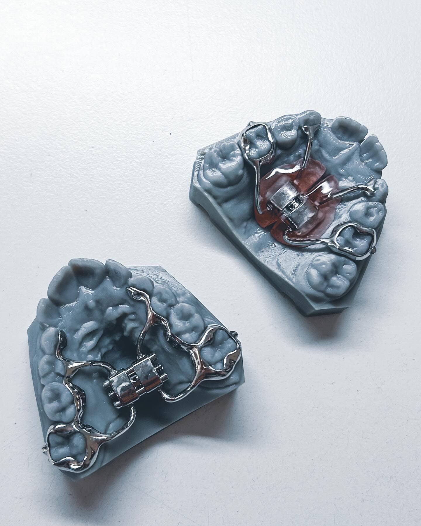 Two palatal expanders on 3D printed models showing digital manufacturing precision