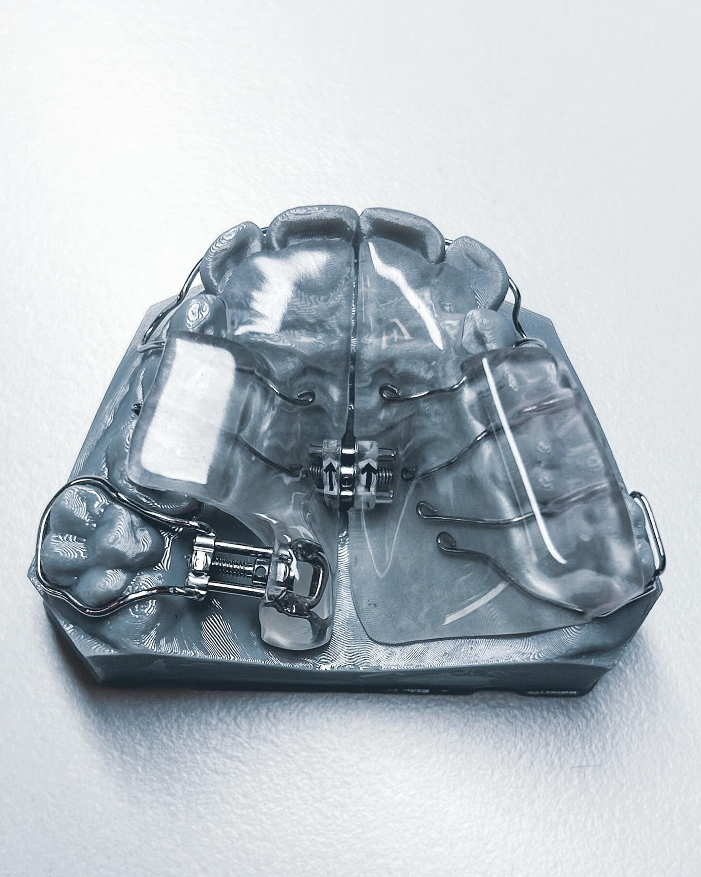 Removable orthodontic appliance with expansion screw and clasps on dental model